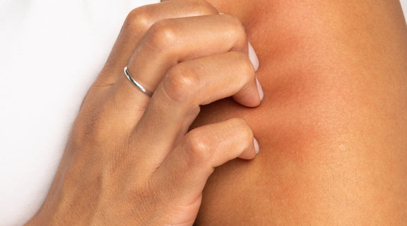 Sensitive skin