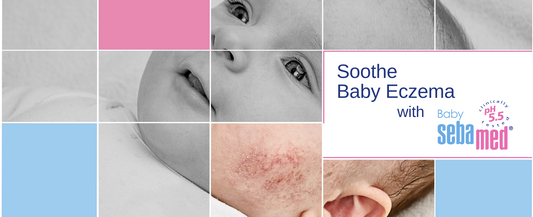 Soothe Baby Eczema with Baby sebamed