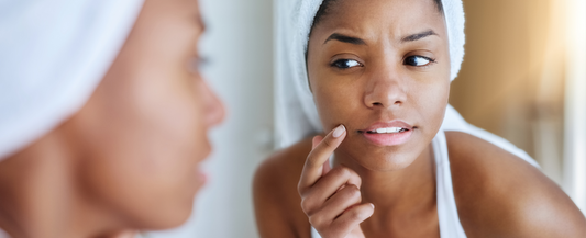 5 Signs Your Skin Isn’t Loving Your Skincare