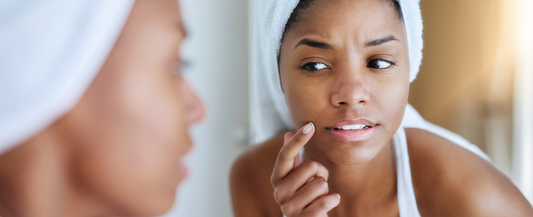 How You are Damaging Your Skin Barrier