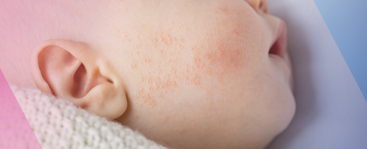 The Science of Newborn Baby's Skin and How to Protect it
