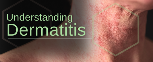 Understanding Dermatitis: Causes, Types and sebamed's Dermatologist-Recommended Solutions