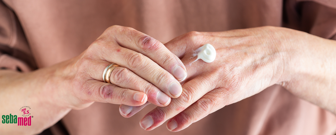 Understanding and Managing Eczema: How sebamed can soothe and protect sensitive skin