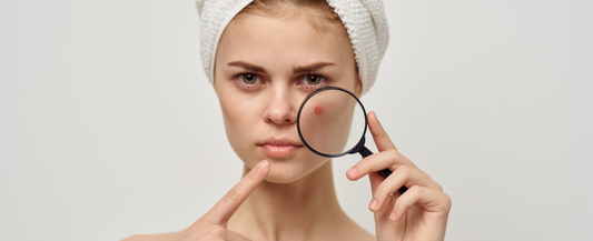 The Effect Of Stress On Your Skin