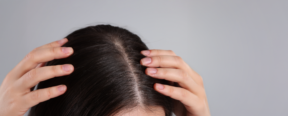 Could Your Scalp Health Be The Root Of Your Hair Hang-ups?
