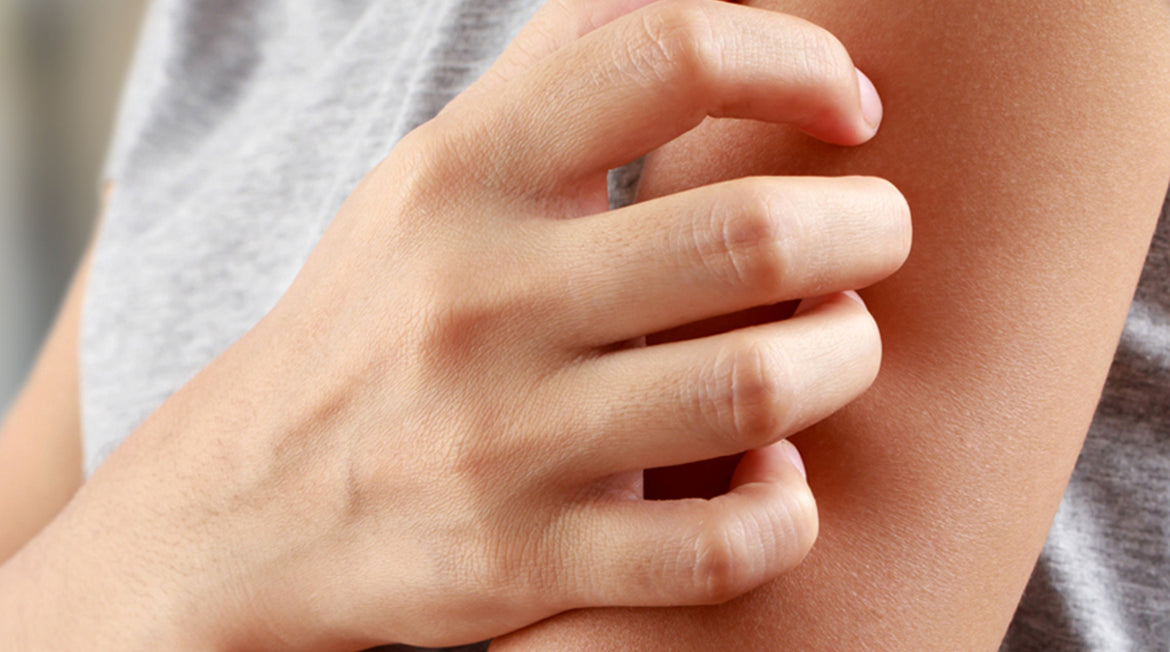 Itchy skin
