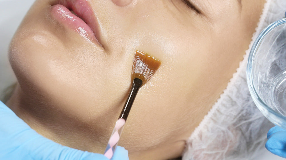 close up of a face getting a skin peel treatment